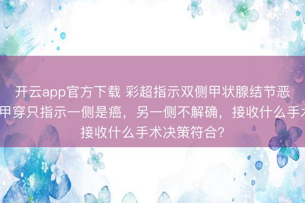 开云app官方下载 彩超指示双侧甲状腺结节恶性可能，但甲穿只指示一侧是癌，另一侧不解确，接收什么手术决策符合？